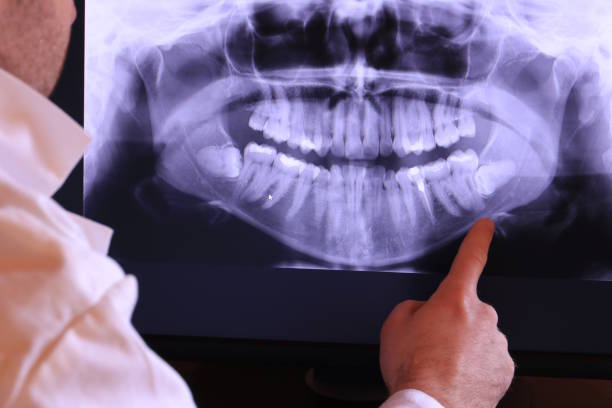 Best Broken or Chipped Tooth Repair in Stratford, OK